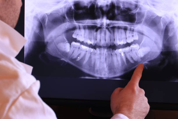 Best Emergency Gum Treatment in Peabody, MA